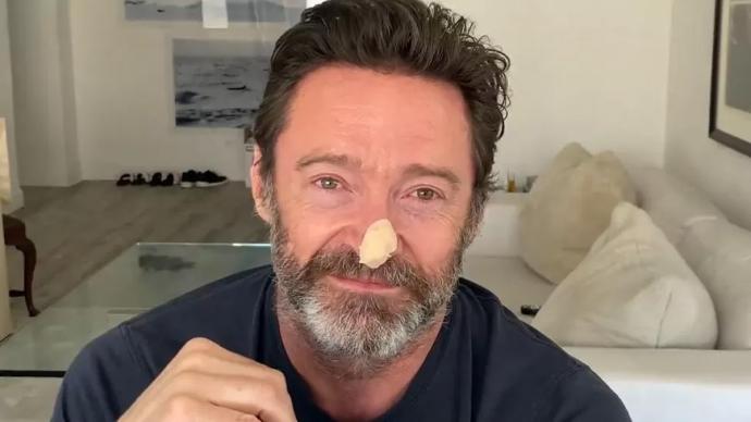Hugh Jackman, The Wolverine, 基底皮肤癌, 防晒, 金刚狼, 