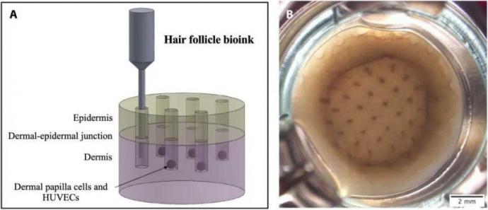 治愈秃头的希望来了 科学家用3D打印让人类毛囊细胞生长
