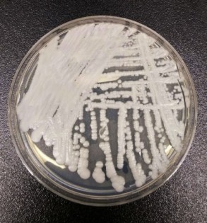 美国疾病防治中心（CDC）在实验室中培养出的“耳念珠菌”。（美联社）