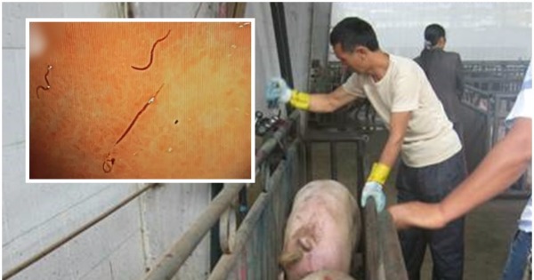 医生分析指，曾男经常赤脚到屠宰场帮忙杀猪，寄生虫可能因此进入其体内。（网上图片）
