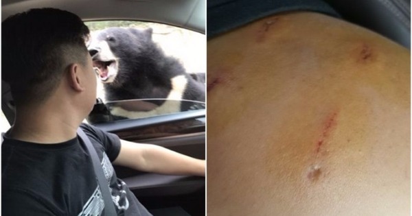 陈男打开车窗投喂黑熊时，遭黑熊咬伤左臂。（网上图片）