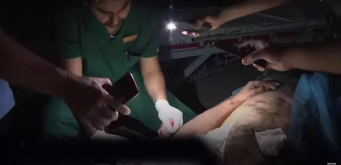 加沙医护人员不得不在黑暗中用手机灯光动手术。